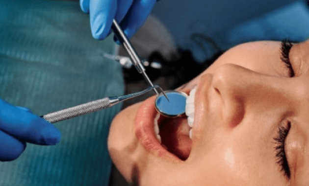 Biaya Cabut Gigi di Puskesmas Tanpa BPJS Pengalaman